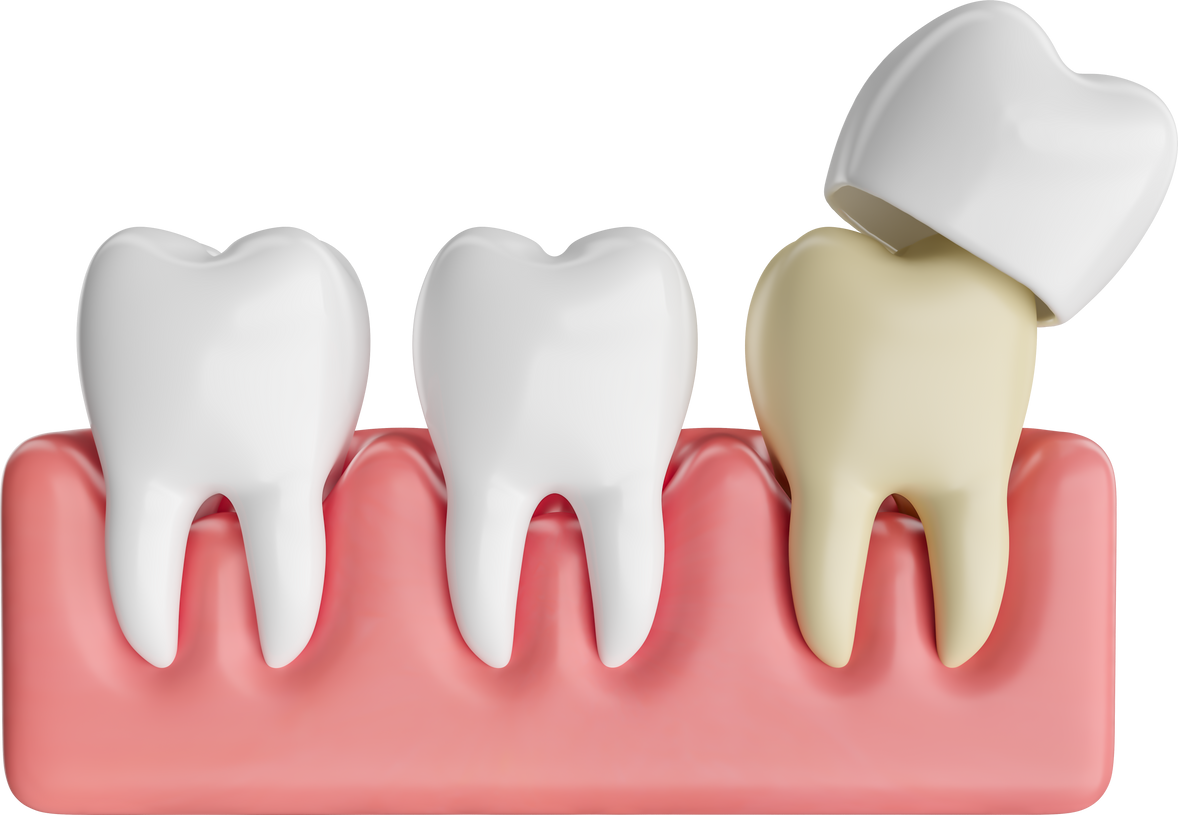 Teeth with gum and dental crown in 3d render